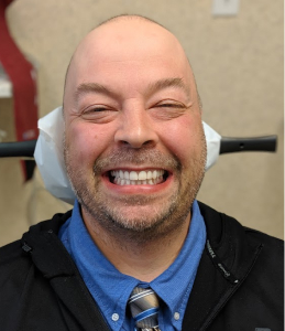 Smile After Image