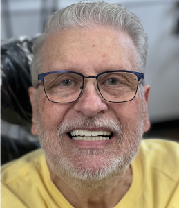 Smile After Image