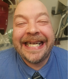Smile Before Image