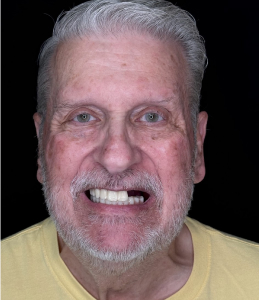 Smile Before Image